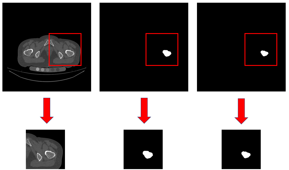 adeeplearningbasedapproachtoextractingperiostealandendosteal