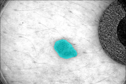 using spatial logic and model checking for nevus segmentation