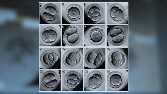最为关键的程序是,医生要通过设备将在培养器皿中的精子送进卵子之内