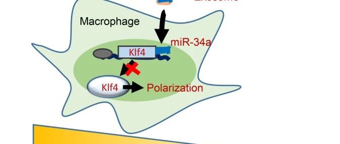 jci香港大学徐爱民组脂肪细胞外泌体mir34a抑制m2巨噬细胞极化促进